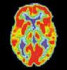 neuromarketing istražuje podražaje u mozgu